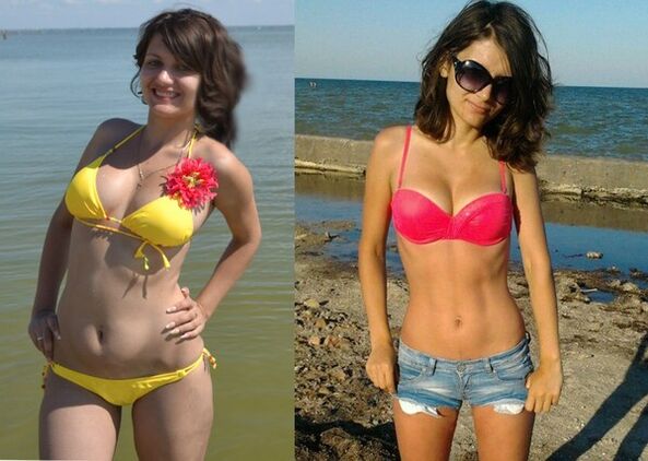 Anna su NexaSlim numetė 10 kg